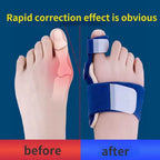 HalluxEase Verstellbare Hallux Valgus Schiene mit Zehentrenner und Fußgewölbestütze