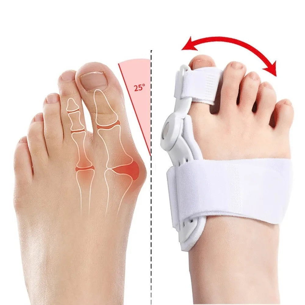 HalluxEase Verstellbare Hallux Valgus Schiene mit Zehentrenner und Fußgewölbestütze